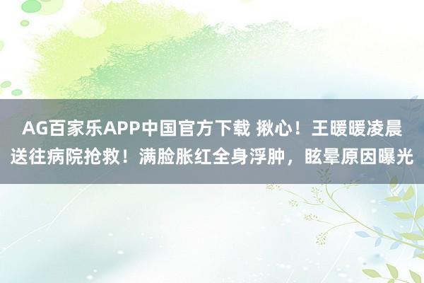 AG百家乐APP中国官方下载 揪心！王暖暖凌晨送往病院抢救！满脸胀红全身浮肿，眩晕原因曝光